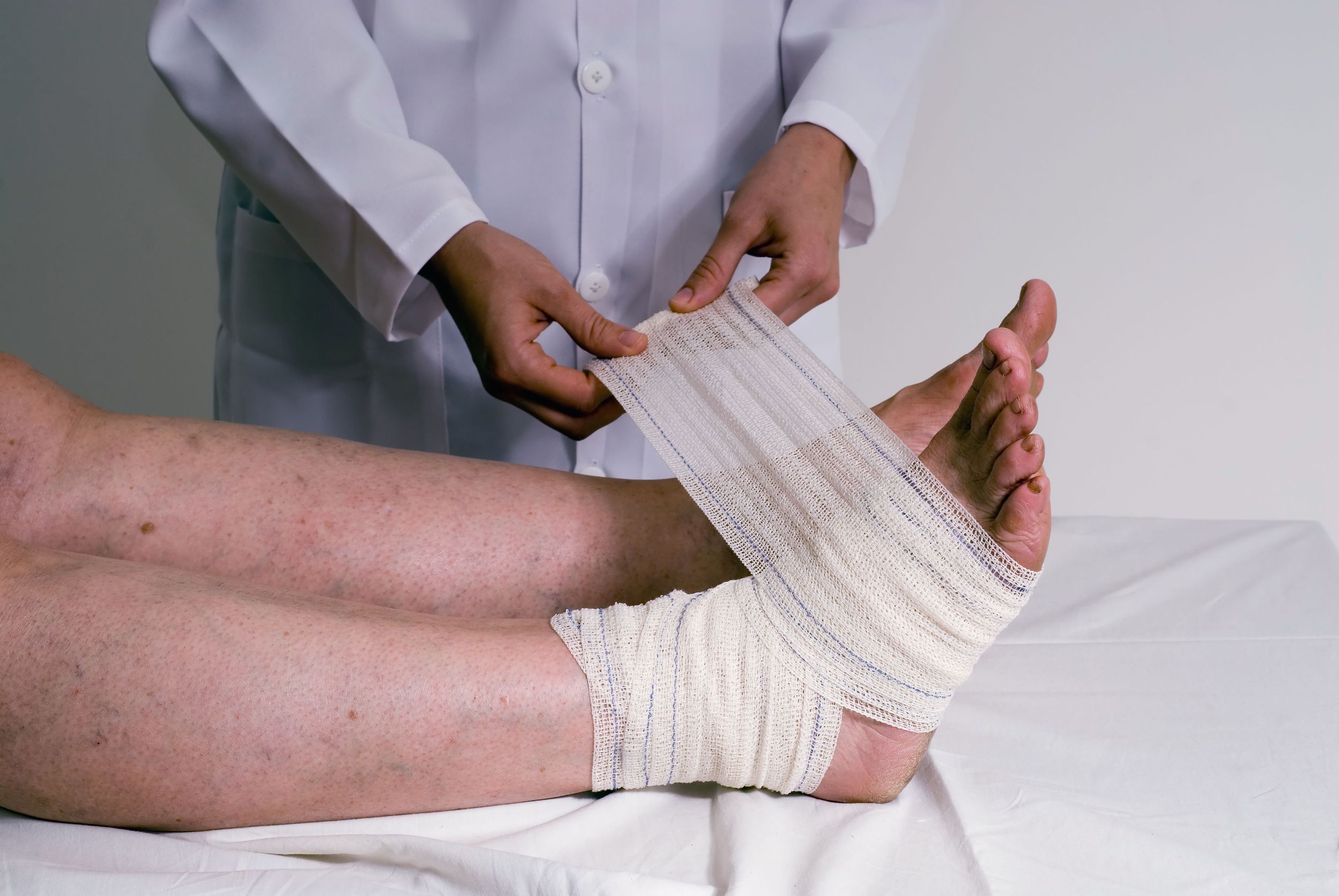 Foot And Ankle Surgery in Naples FL – Making the Most of Recovery