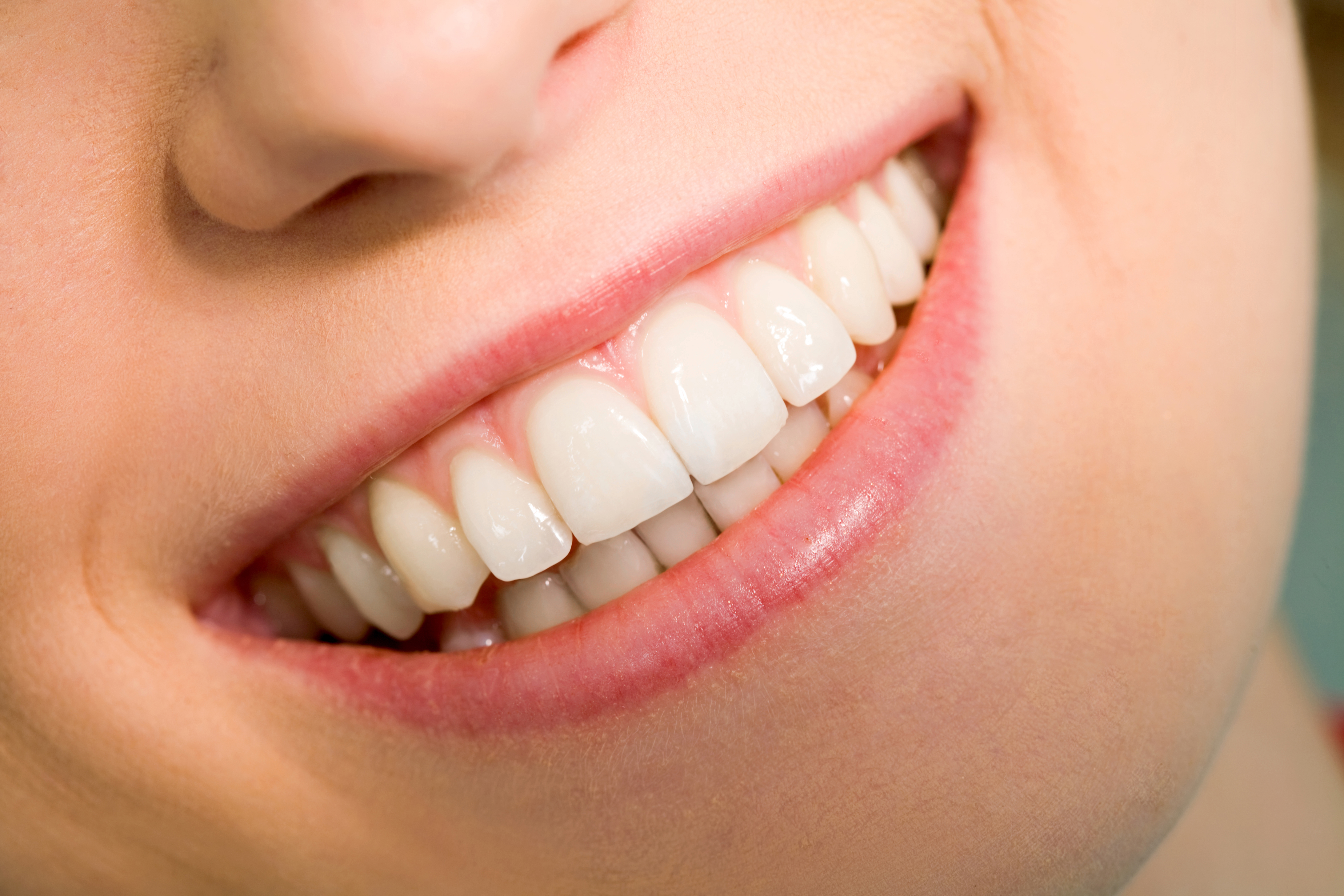 Why the Dentist is Recommending a Porcelain Veneer in Marietta GA