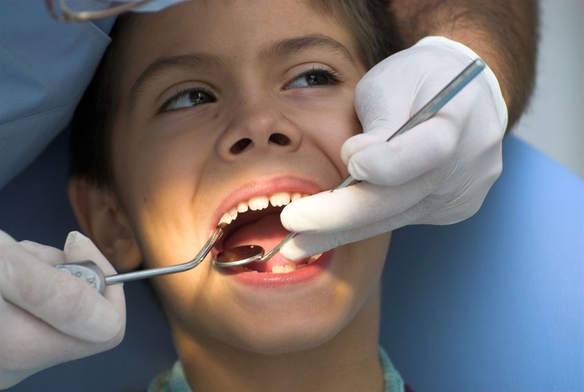 The Dentist in Katy Can Protect Your Tooth With a Crown