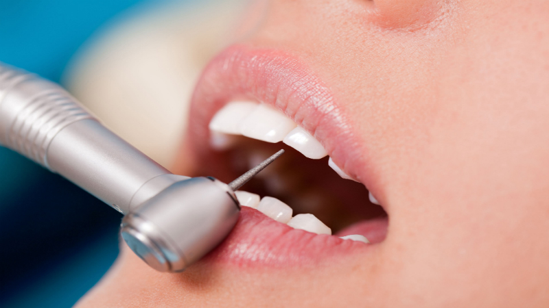 The Importance Of Preventative Dental Care