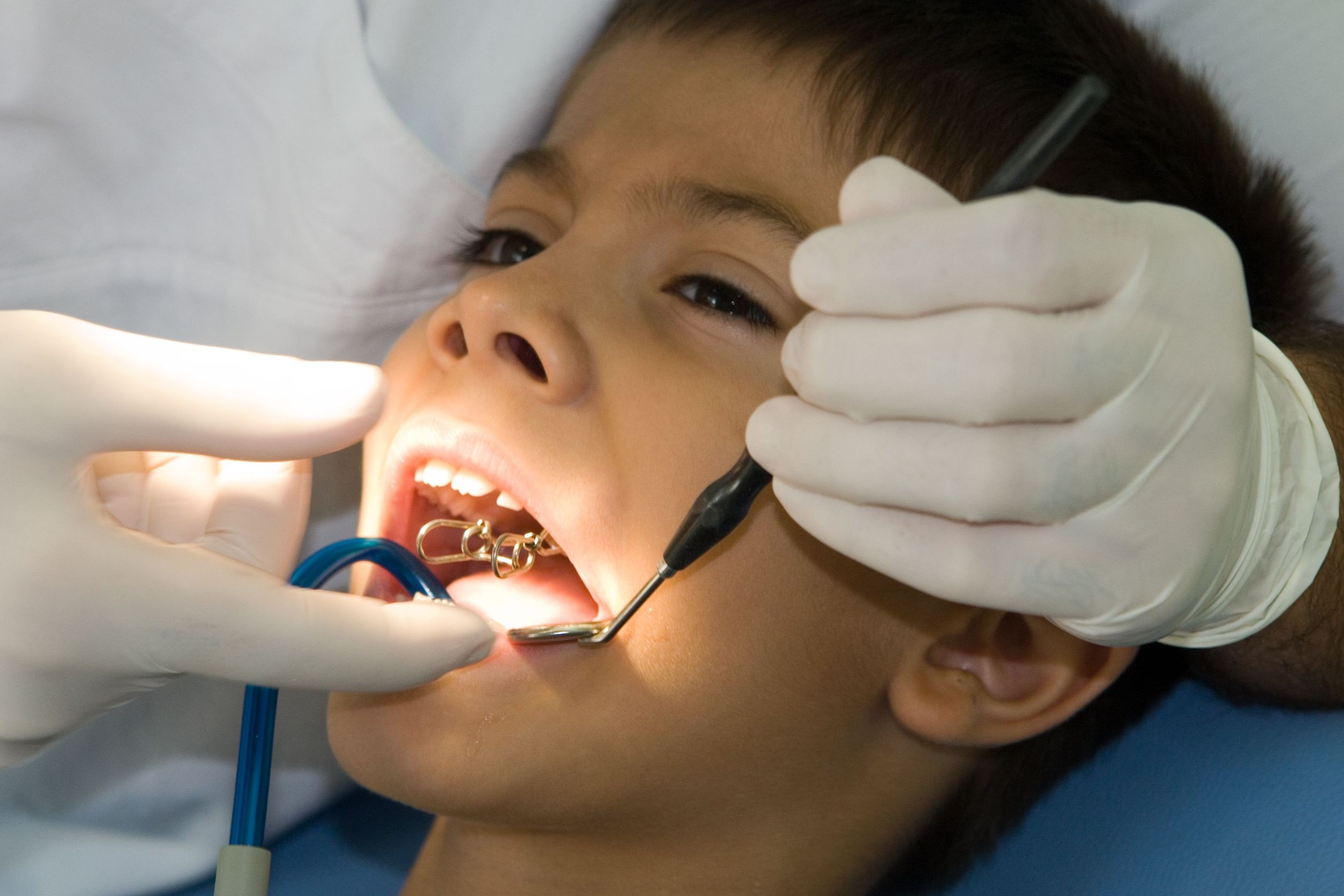 What You Need to Know to Find an Expert of Children Dentistry in New Hyde Park, NY