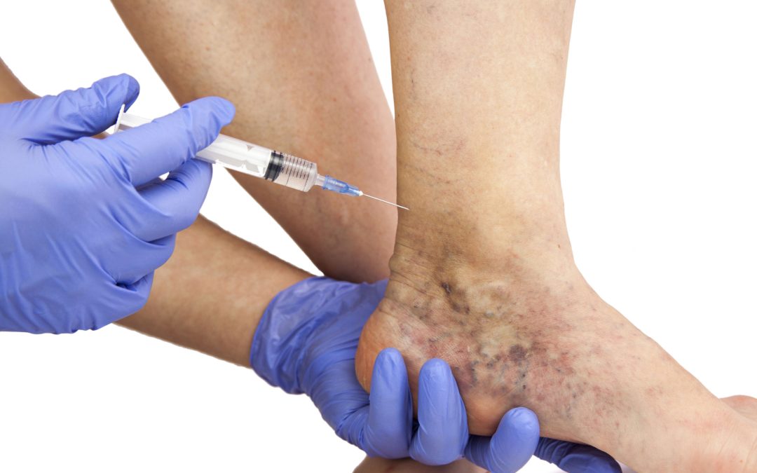 Discover Advanced Foot Care Solutions with a Podiatrist in Geneva, IL