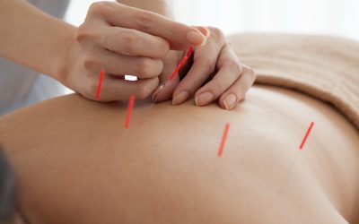 Seeking pain relief? Try acupuncture for pain in Midtown NYC