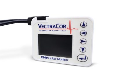 Understanding ECG Holter Monitor: What You Need to Know